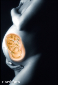 Terhességi fogyás