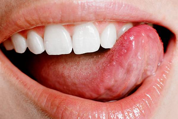 hogyan lehet eltávolítani a nyelv vörös foltjait