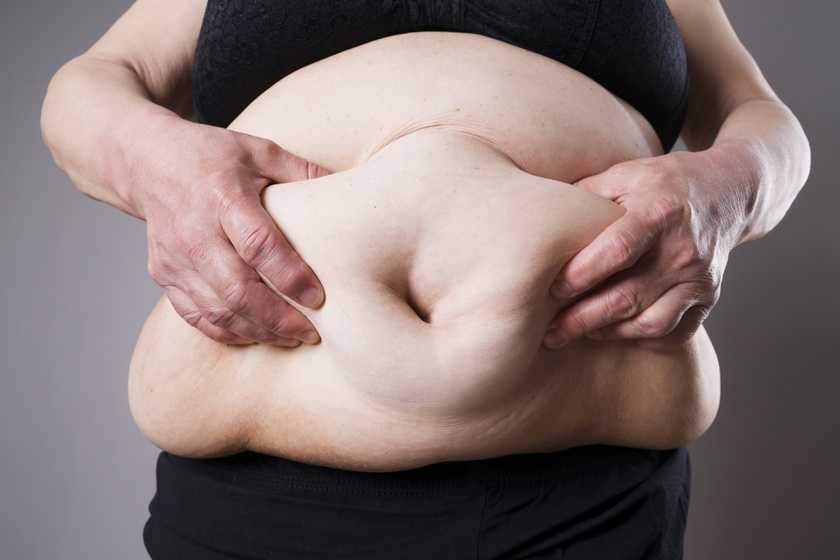 Fogyni morbidly elhízott - Milyen betegségekkel kerülnek ide a páciensek?
