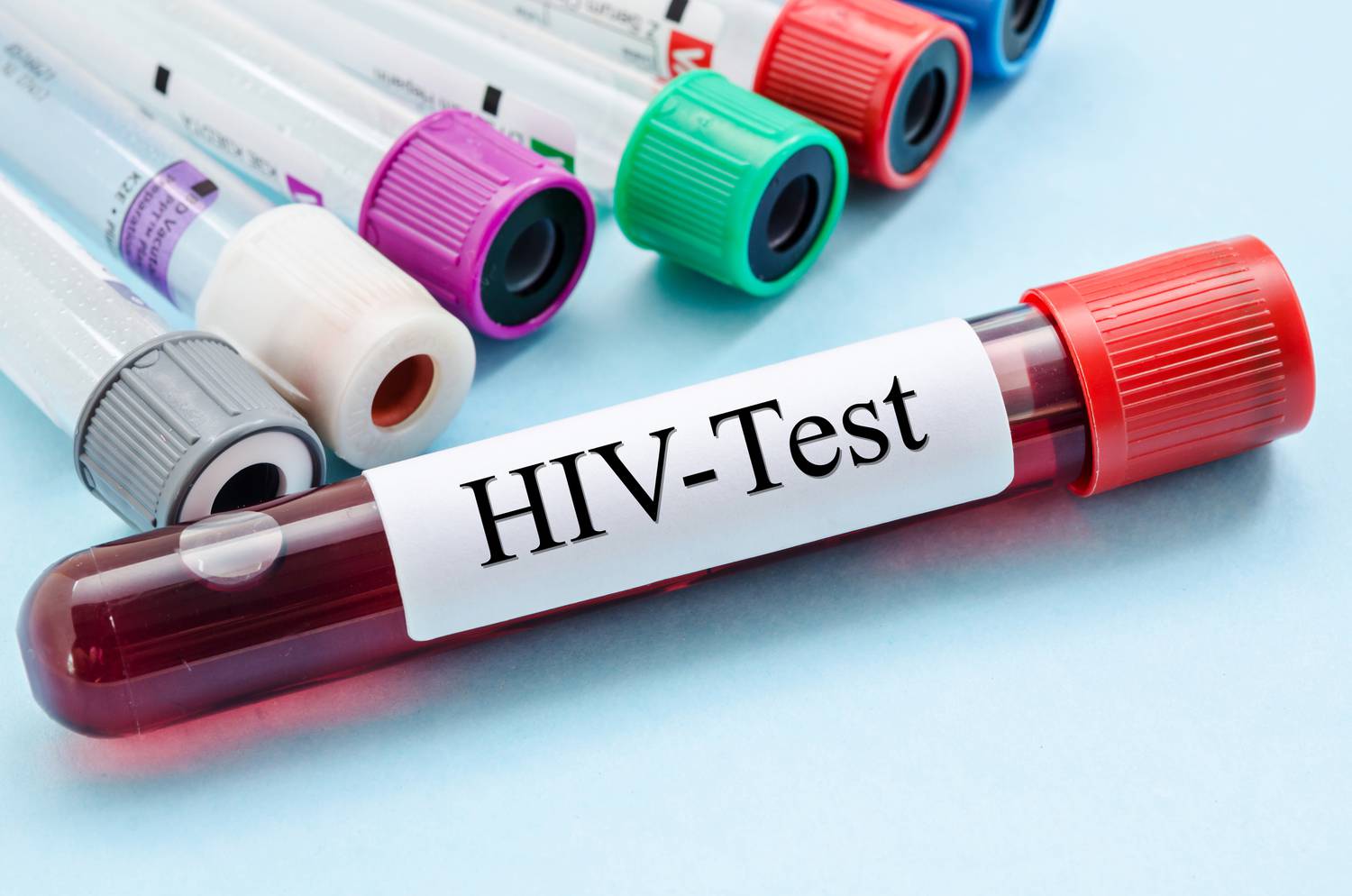 Hasmenés, köhögés, fekélyek: a HIV-fertőzés tünetei