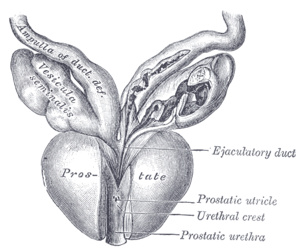 urethritis erekcióval