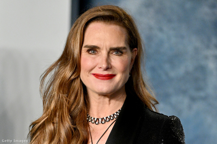 Brooke Shields egy olyan kiskutyát fogadott örökbe, akit senki más nem akart