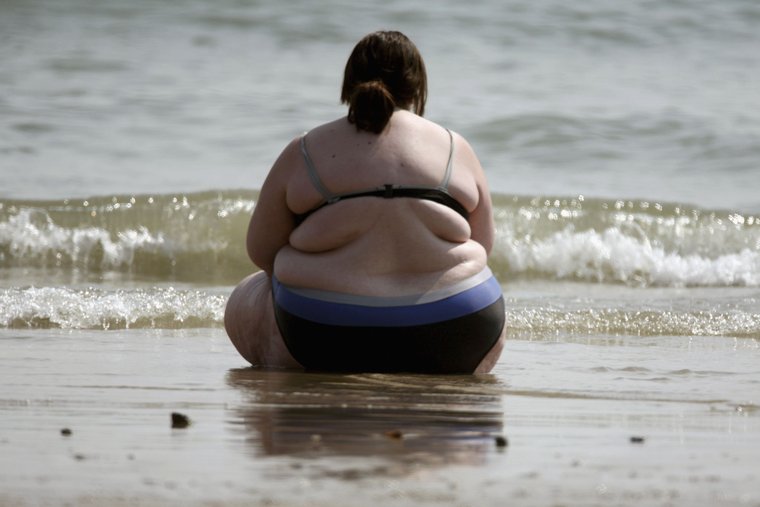 Égő kövér ember. Szimpatika – Kövér ember is lehet alultáplált, Az égő kövér ember