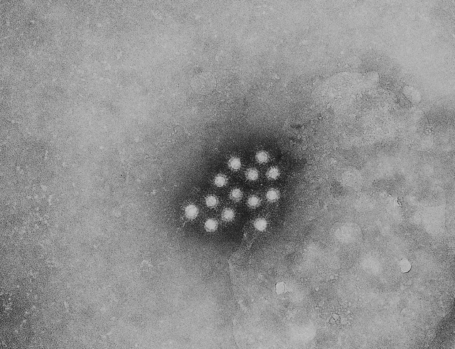 A hepatitis A vírus elektronmikroszkópos felvétele