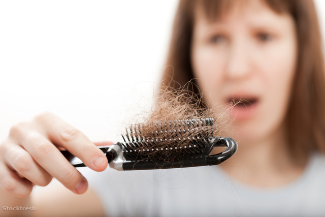 stockfresh 611498 loss-hair-comb-in-women-hand sizeM