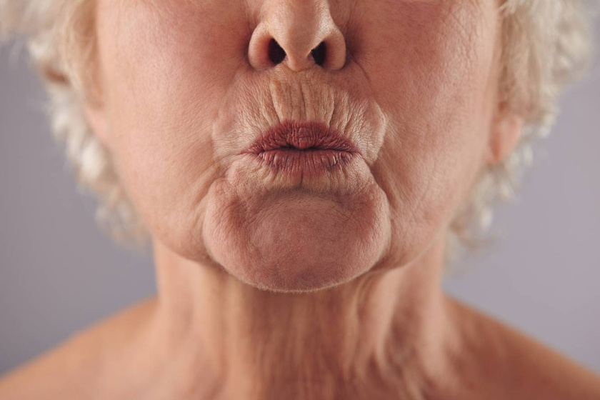 nem invazív anti aging eljárások legjobb anti aging kezelés arcra