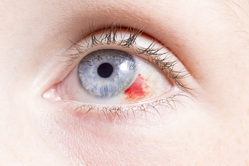 A szem alatti ideges tic kezelést okoz