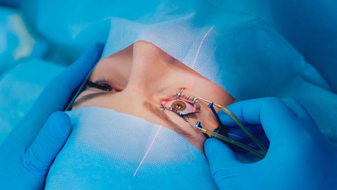lézeres szemműtét hyperopia lásd ujjaival a bőrön
