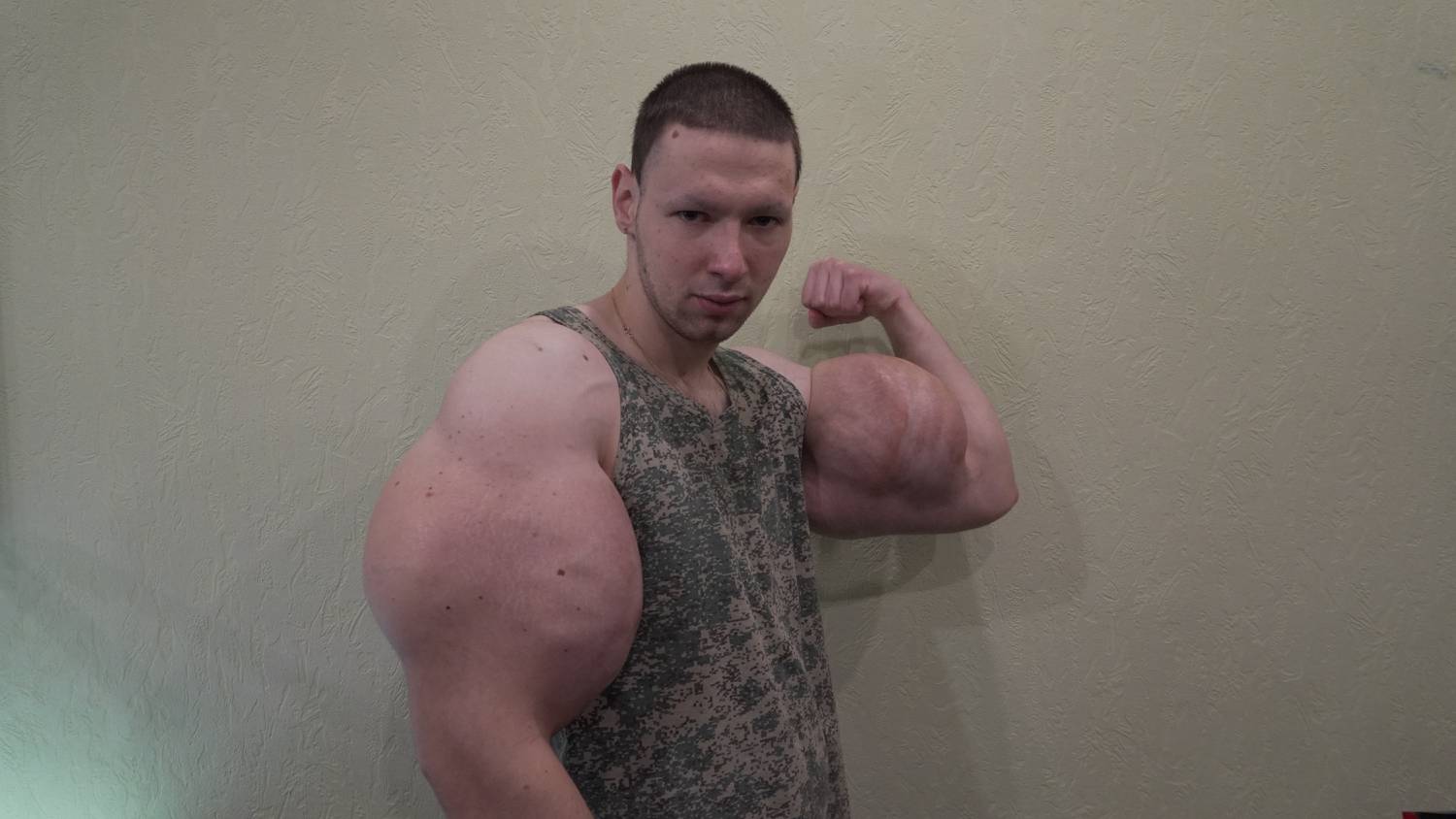Oroszország legnagyobb bicepsze a syntholtól ekkora