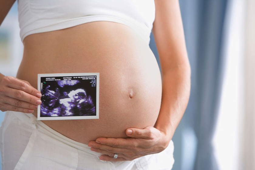 ultrahang a visszerek terhesség alatt