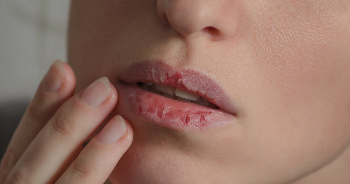 Betegség a száj acetonszagának jeleivel - cm3.hu