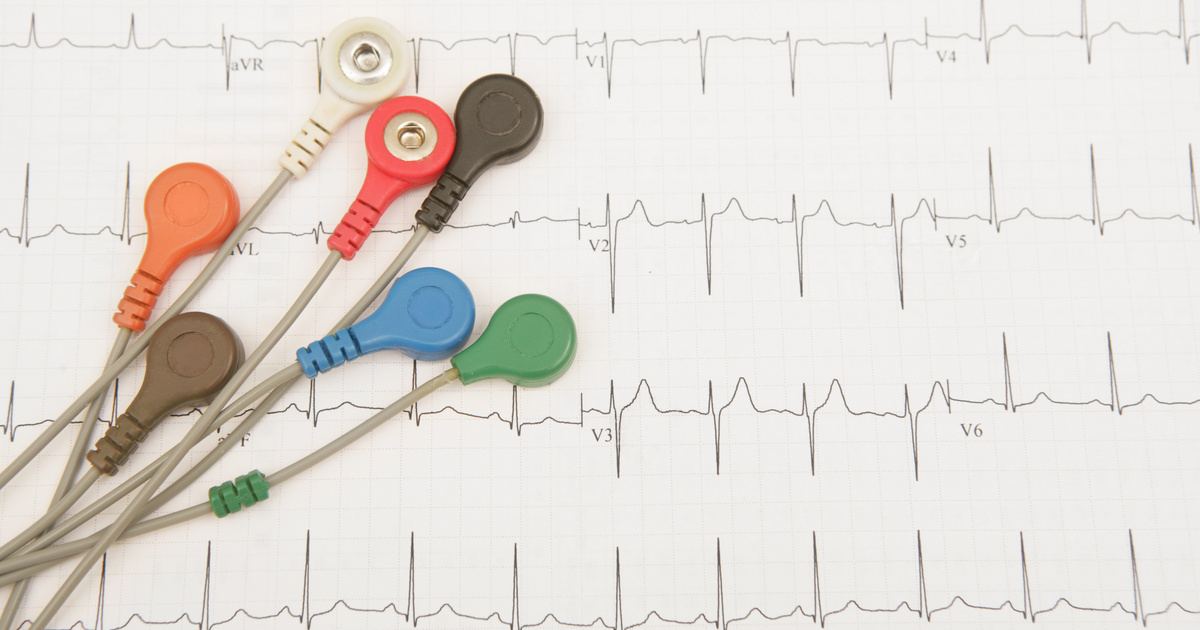Mikor nem elég az egyszerű EKG-vizsgálat? 11 kérdés, amire k