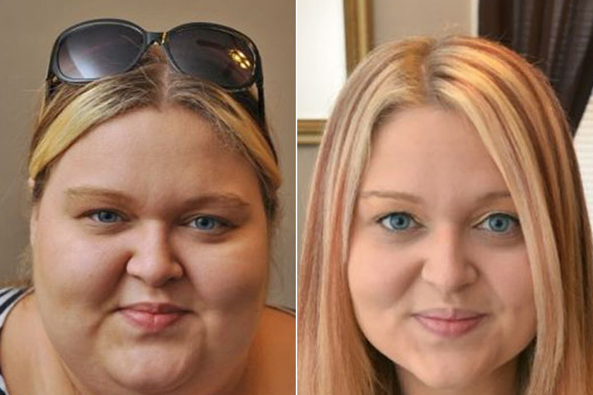 Ilyen egy női arc 50 kiló fogyás után: megdöbbentőek az előtte-utána képek - Fogyókúra | Femina