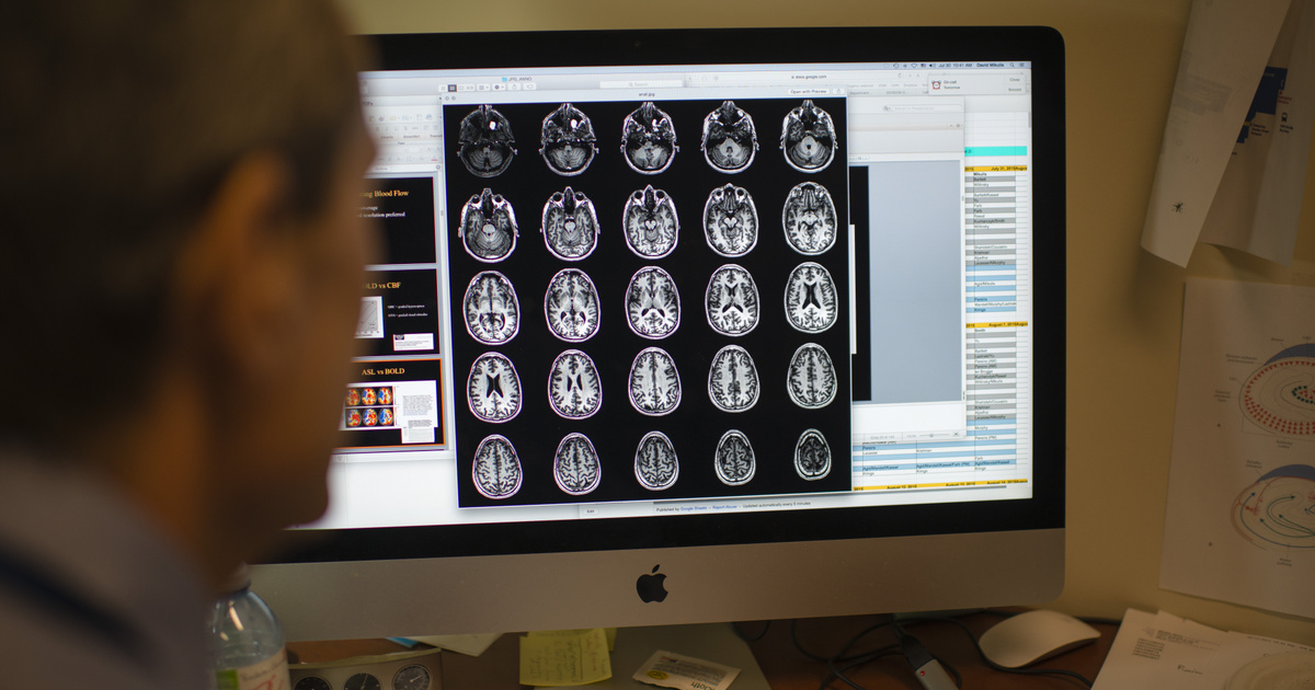 Index – Tech-Science – Se han identificado cuatro subtipos de enfermedad de Alzheimer