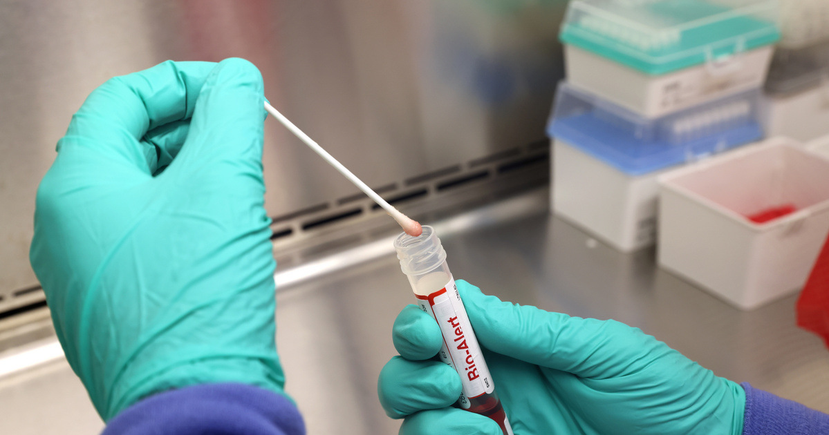 Índice – Tech-Science – La viruela del mono podría detenerse en Europa