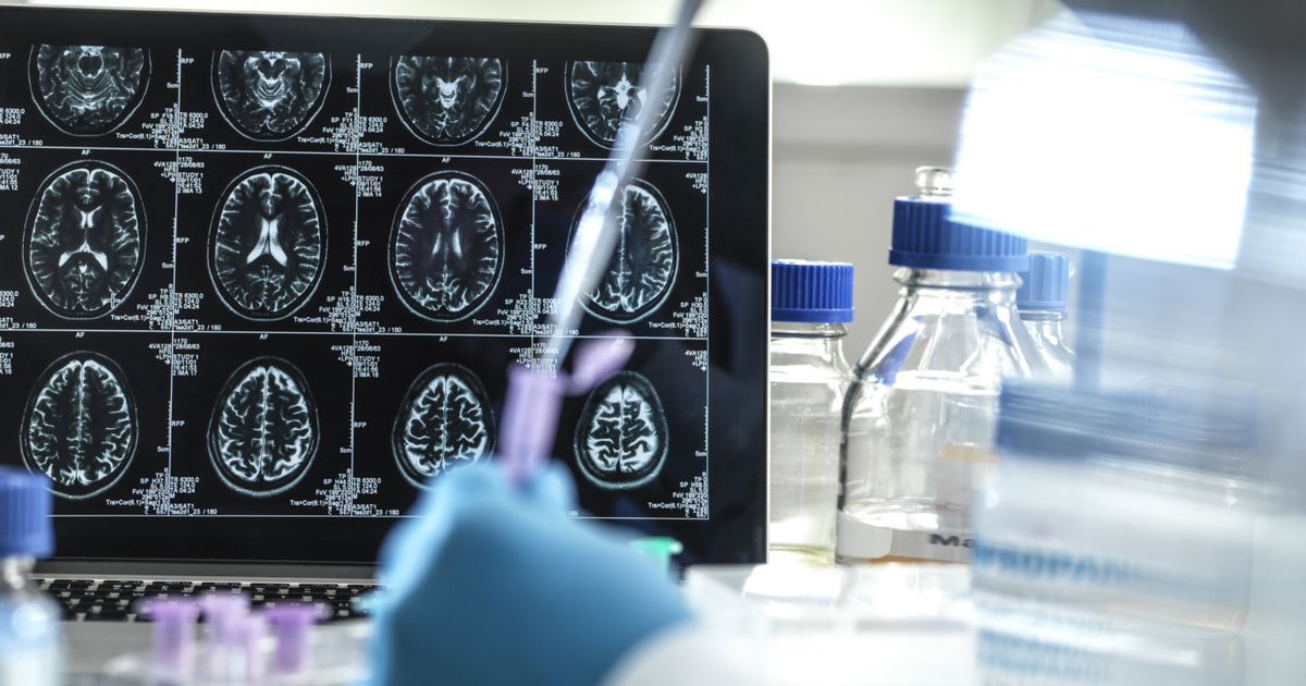 Bibliografía – Tech-Science – Nunca ha habido un avance tan grande en el tratamiento de la enfermedad de Alzheimer