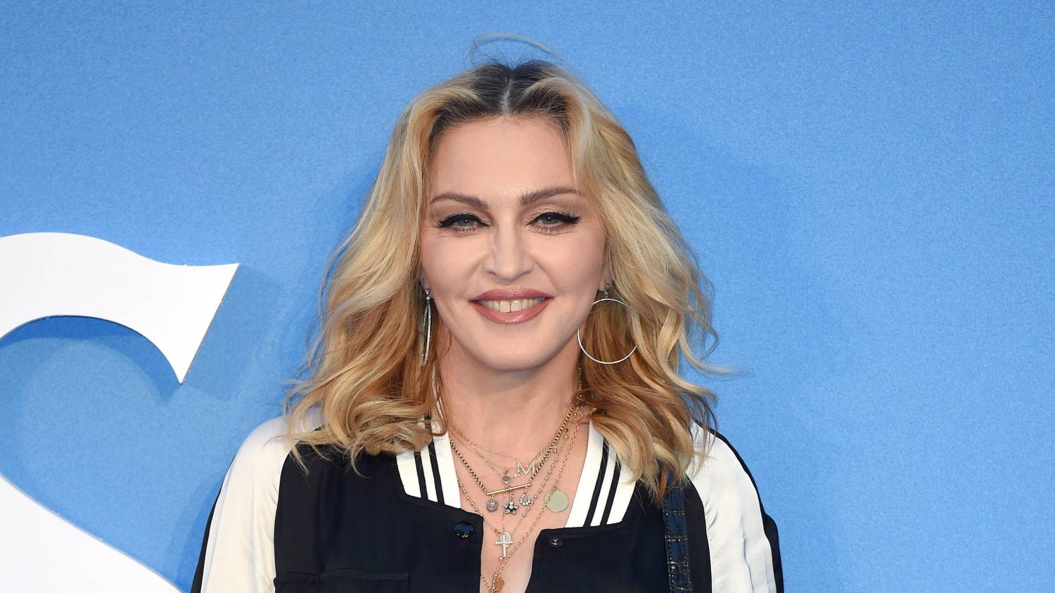 Madonna túl van az életveszélyen, már táncra is perdült az énekesnő