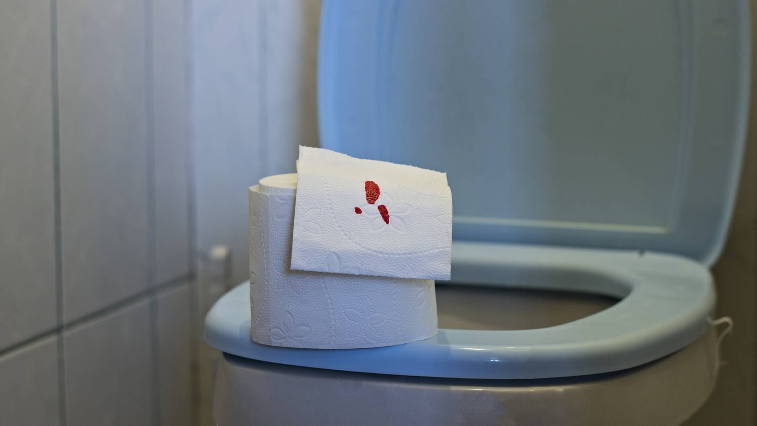 После стула крови на туалетной бумаге. Кровь на туалетной бумаге. Небольшие следы крови на туалетной бумаге.