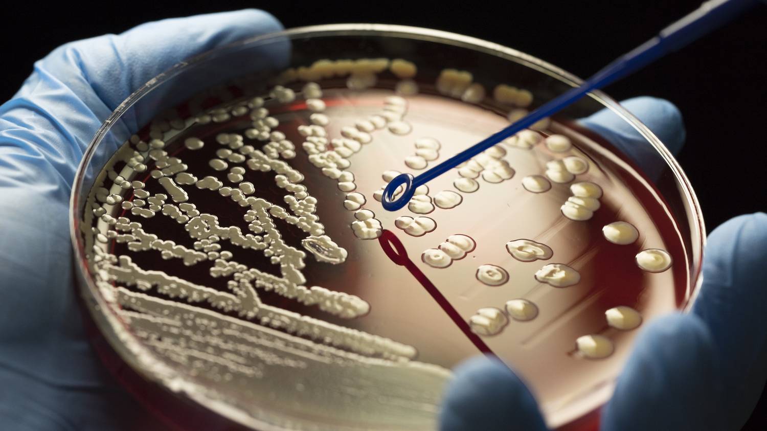 Emberi vérre szomjazó halálos baktériumokat fedeztek fel tudósok