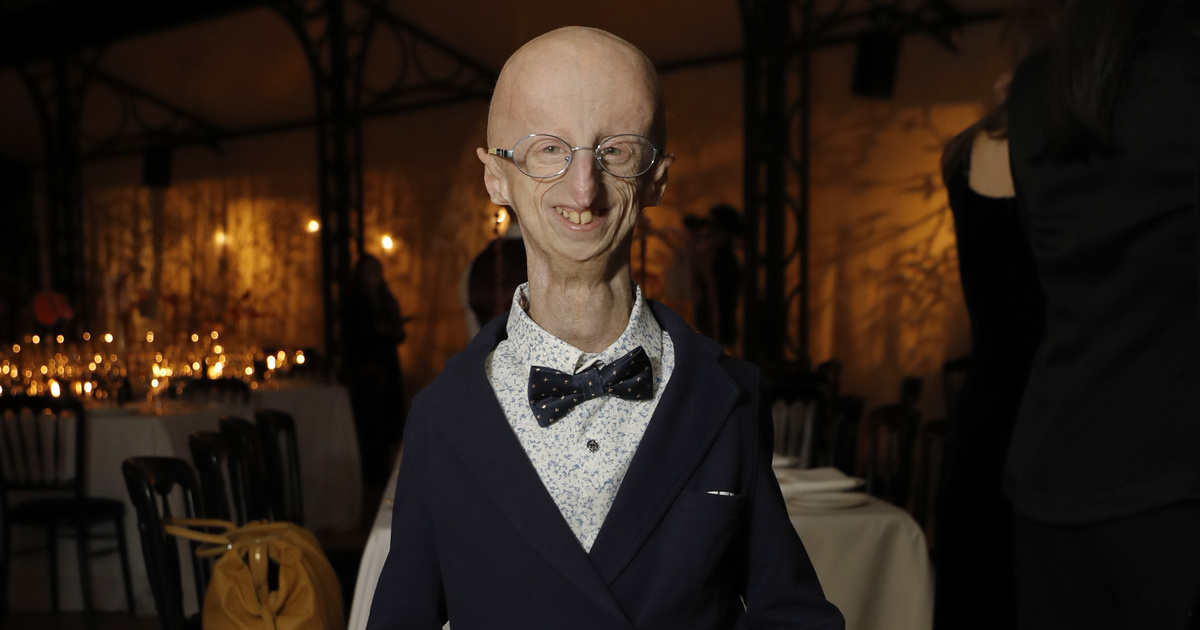 Index – Abroad – The world's tallest progeria patient has died at the age of 28