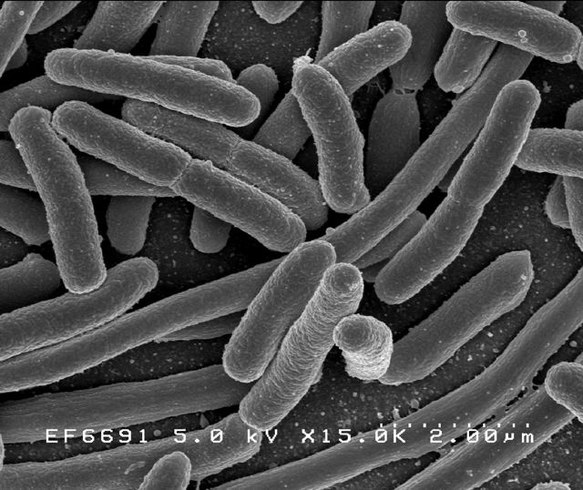 E. coli baktérium