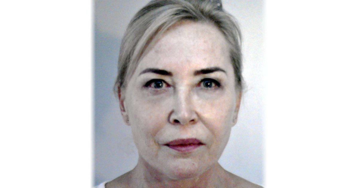 Gerincműtétje után eltűnt Szegeden a szekszárdi kórház egyik főorvosa