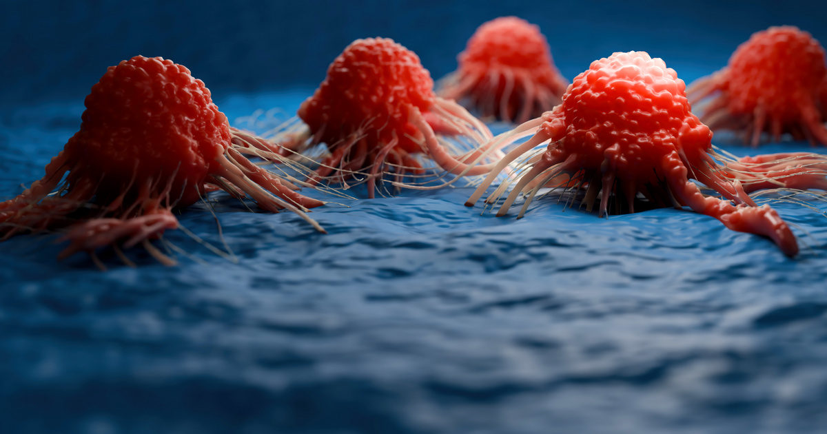 Magas a rák kockázata a családban? Így csökkenthető a rizikó