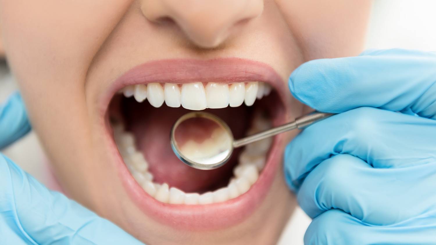 A fogorvos 3 egyszerű tippje: ha ezeket betartja, hibátlanok lesznek a fogai