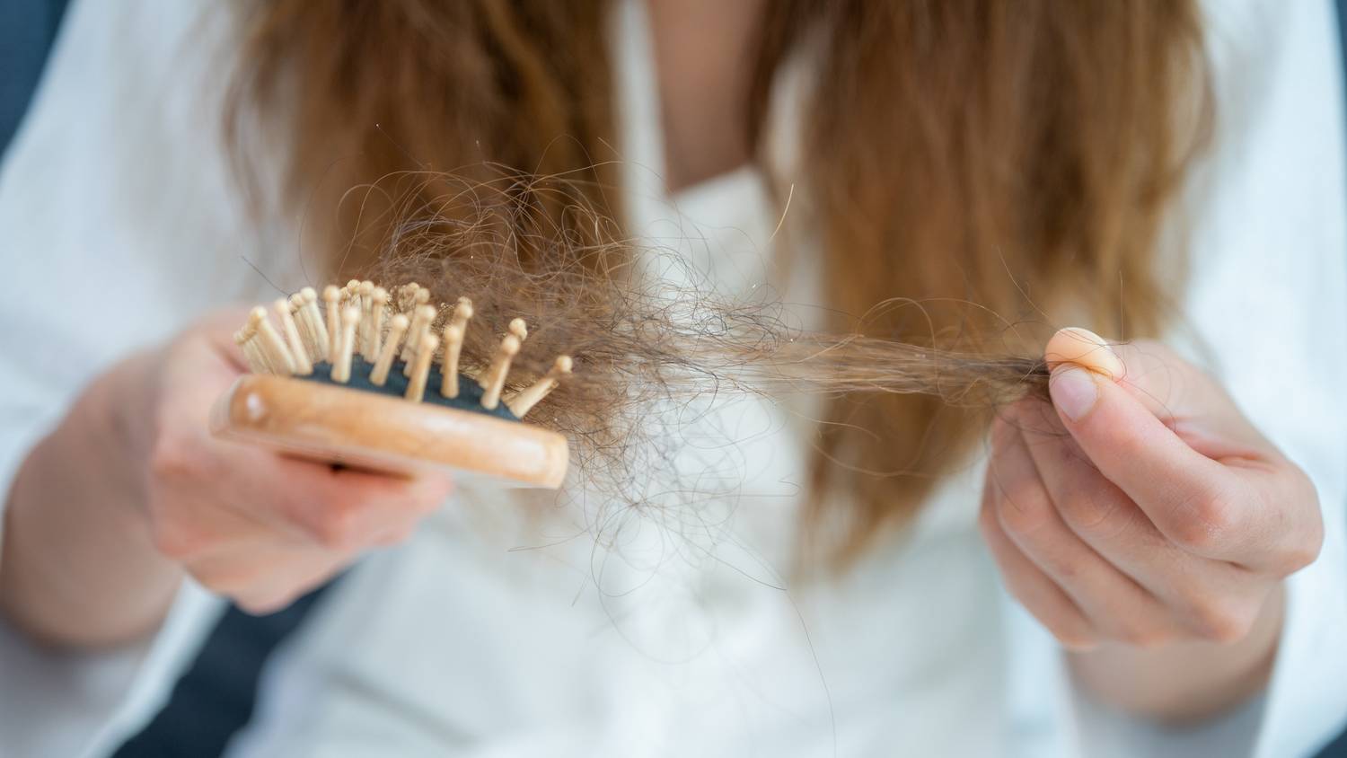 Nem is gondolná: ez az étel sokak kedvence, azonban erős hajhullást okozhat