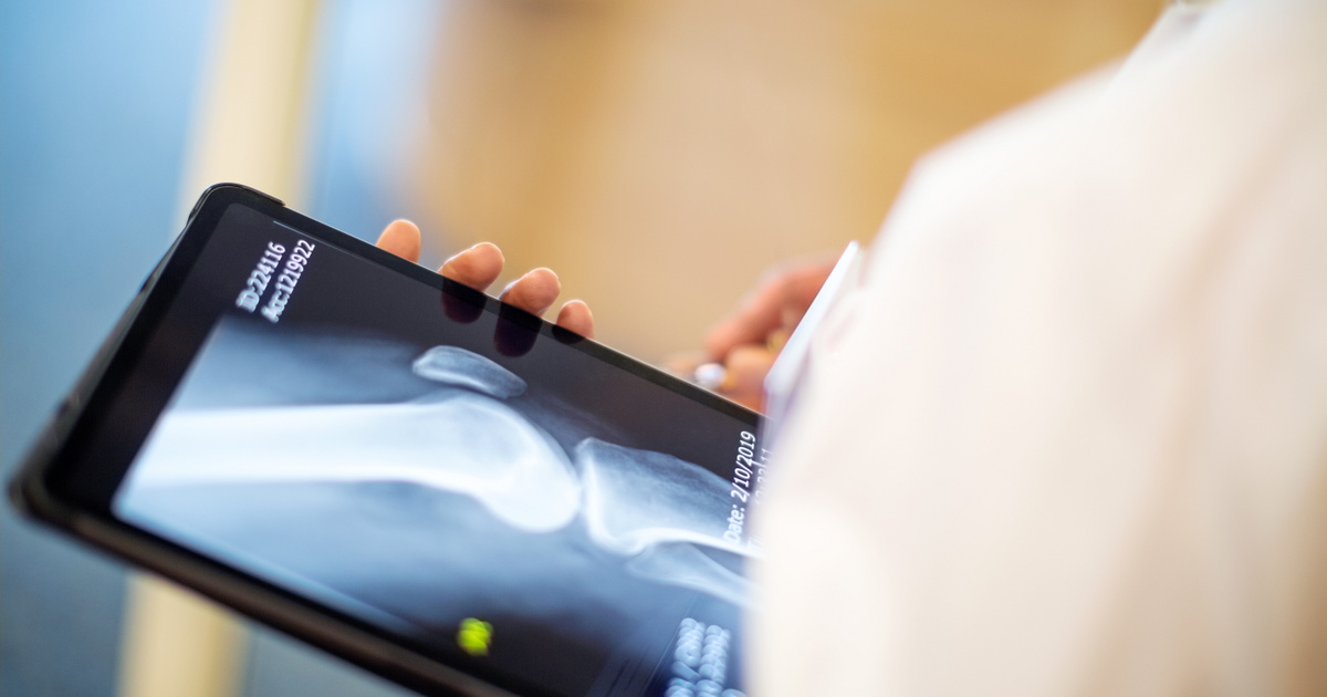 Gyengülnek a csontok és az immunrendszer, ha hiányzik ez a vitamin: ezekre a tünetekre érdemes odafigyelni