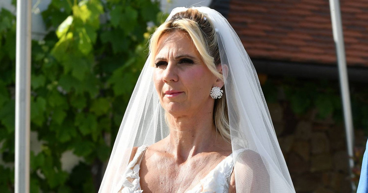 A magyar sztárfeleség arca teljesen más lett a botoxtól: nem így láttuk a tévében