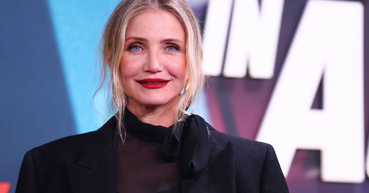 Cameron Diazt plasztikával vádolják: pedig korábban azt mondta, megbánta a botoxot