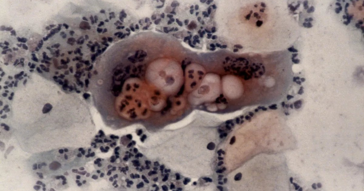 Ez a vírus több ezer éve él bennünk és öröklődik a génjeinkben