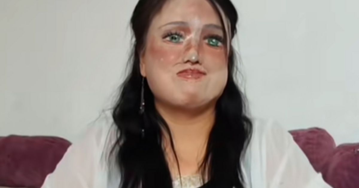 Minden nap újrarajzolja az arcát egy savtámadást túlélő nő