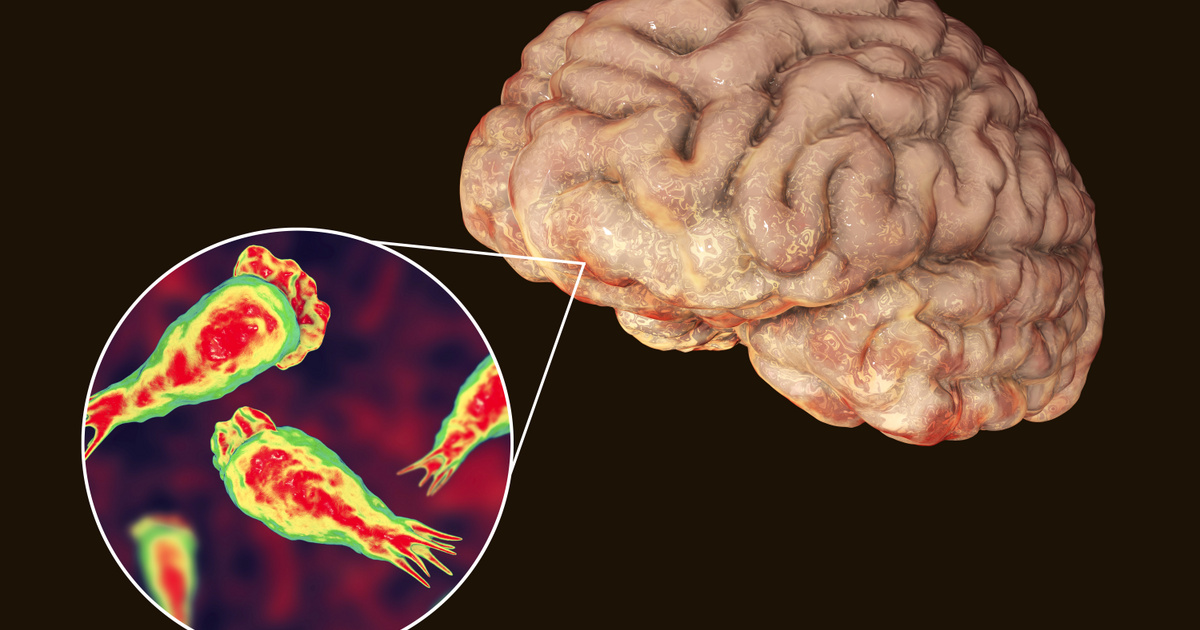 Az agyevő amőba Magyarországon is jelen lehet: figyelmeztetnek a szakemberek