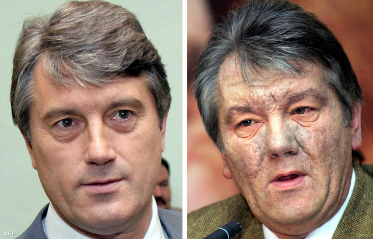 Viktor Juscsenko mérgezése előtt és után