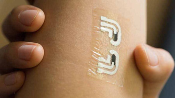 Tetoválás válthatja az inzulinos tűt