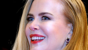 Nicole Kidman arca mintha viaszból lenne