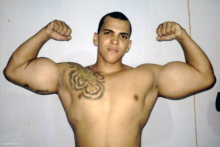 Az egykor testőrként dolgozó brazil férfi nem volt elégedett ezzel a bicepszmérettel, ezért szintetikus olaj és alkohol keverékét injekciózta az izmaiba